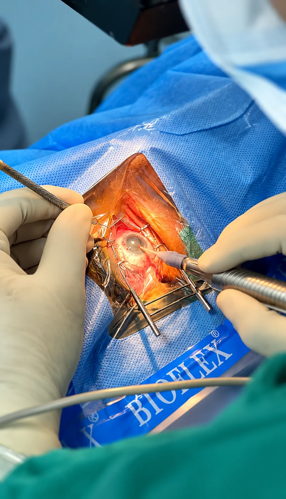 Ophthalmic surgeon using an operating microscope